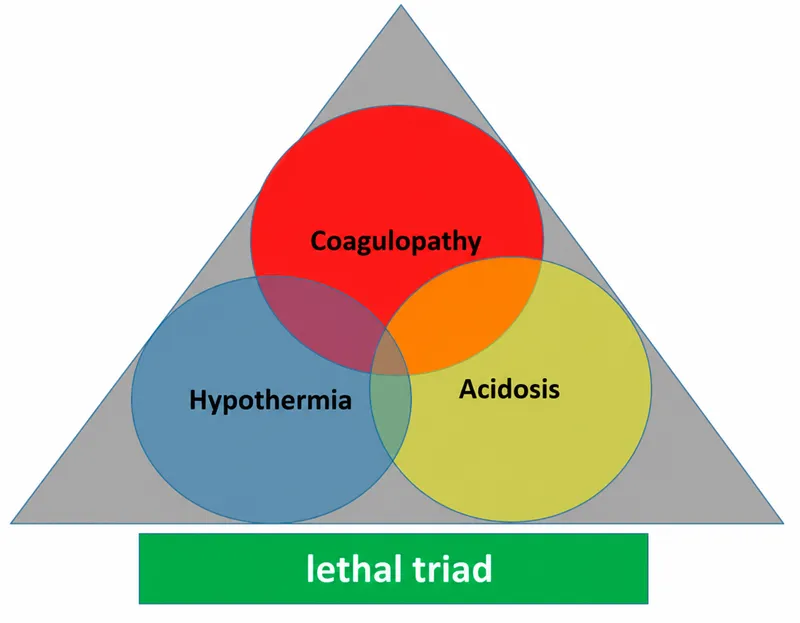 Lethal Triad of Trauma