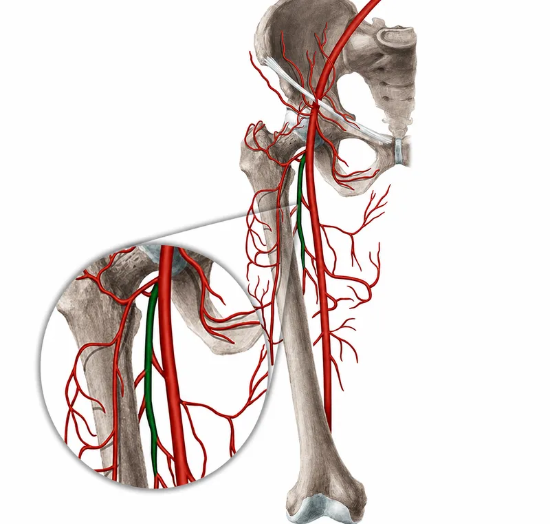 Femoral artery and profunda femoris branches