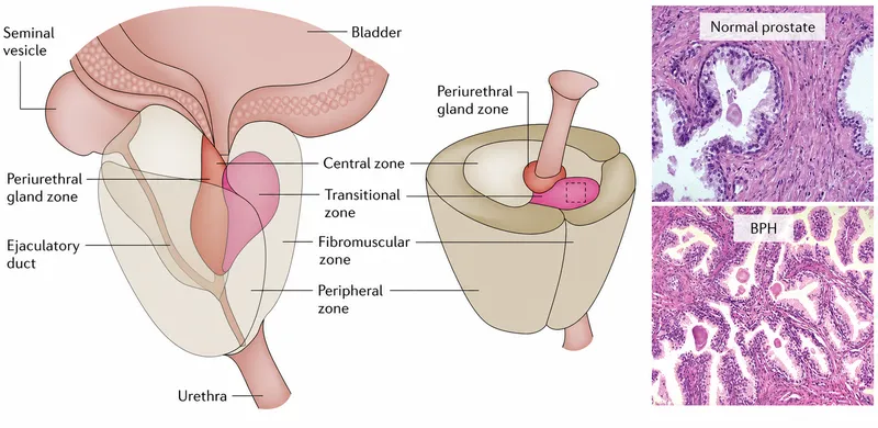 Prostate anatomy and BPH histology
