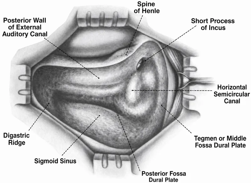 Surgical anatomy of mastoid bone