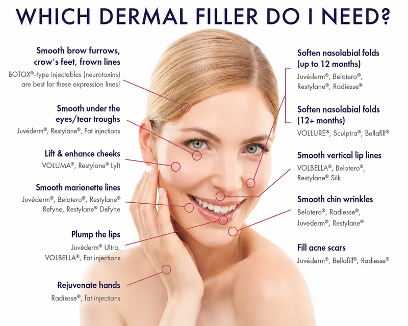 Dermal filler types and injection areas