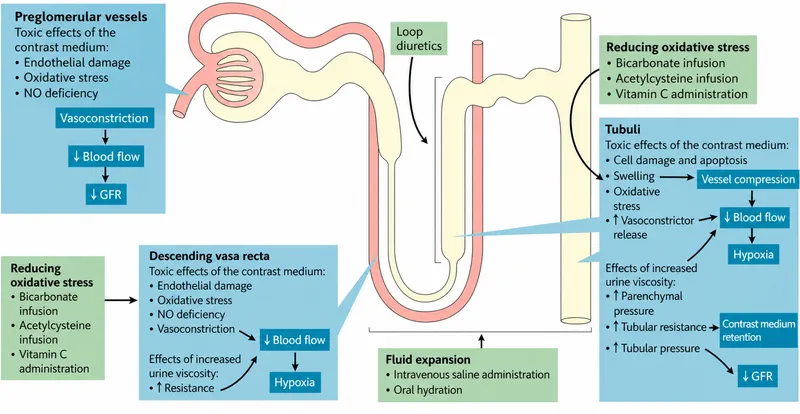 Nephron diagram: Contrast-induced nephropathy