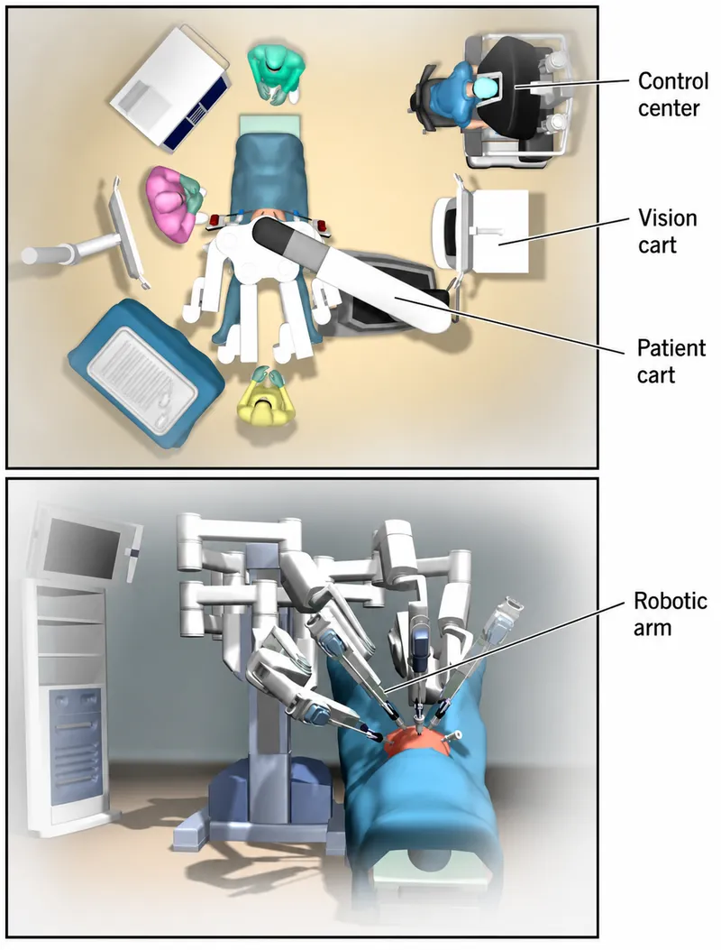da Vinci Robotic Surgery OR Setup and Robotic Arm