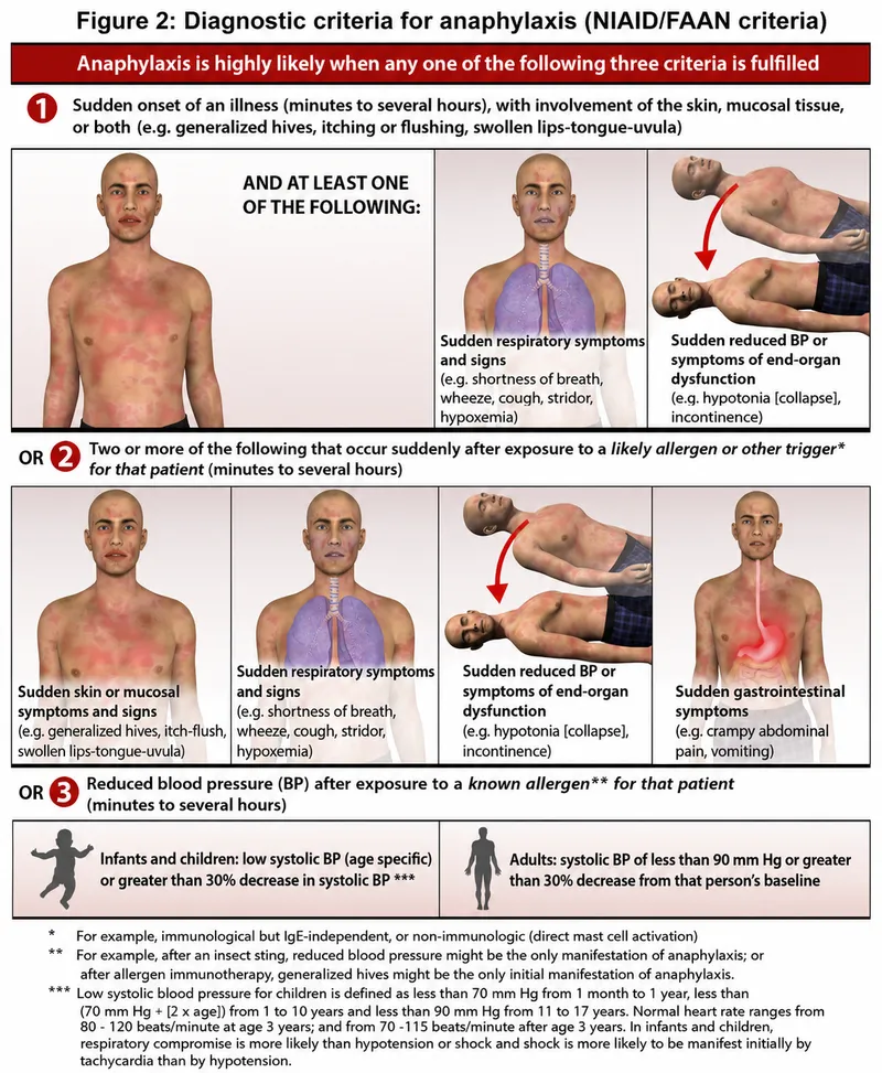 Anaphylaxis Diagnostic Criteria (NIAID/FAAN)