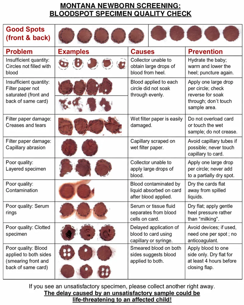 Newborn Screening Blood Spot Specimen Quality