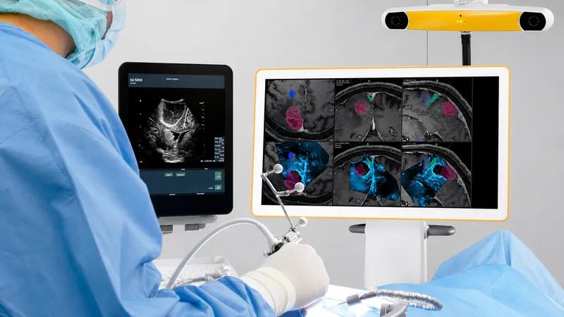 Intraoperative ultrasound guiding tumor resection with real-time imaging