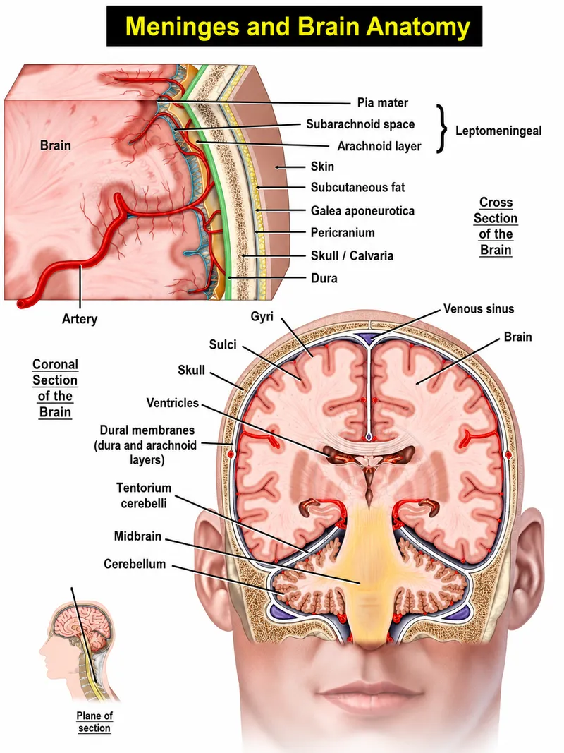 Coronal section showing dural layers and venous sinus anatomy
