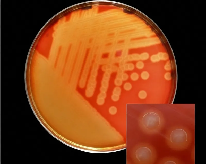 Bacterial culture plate showing beta-hemolytic streptococcus colonies