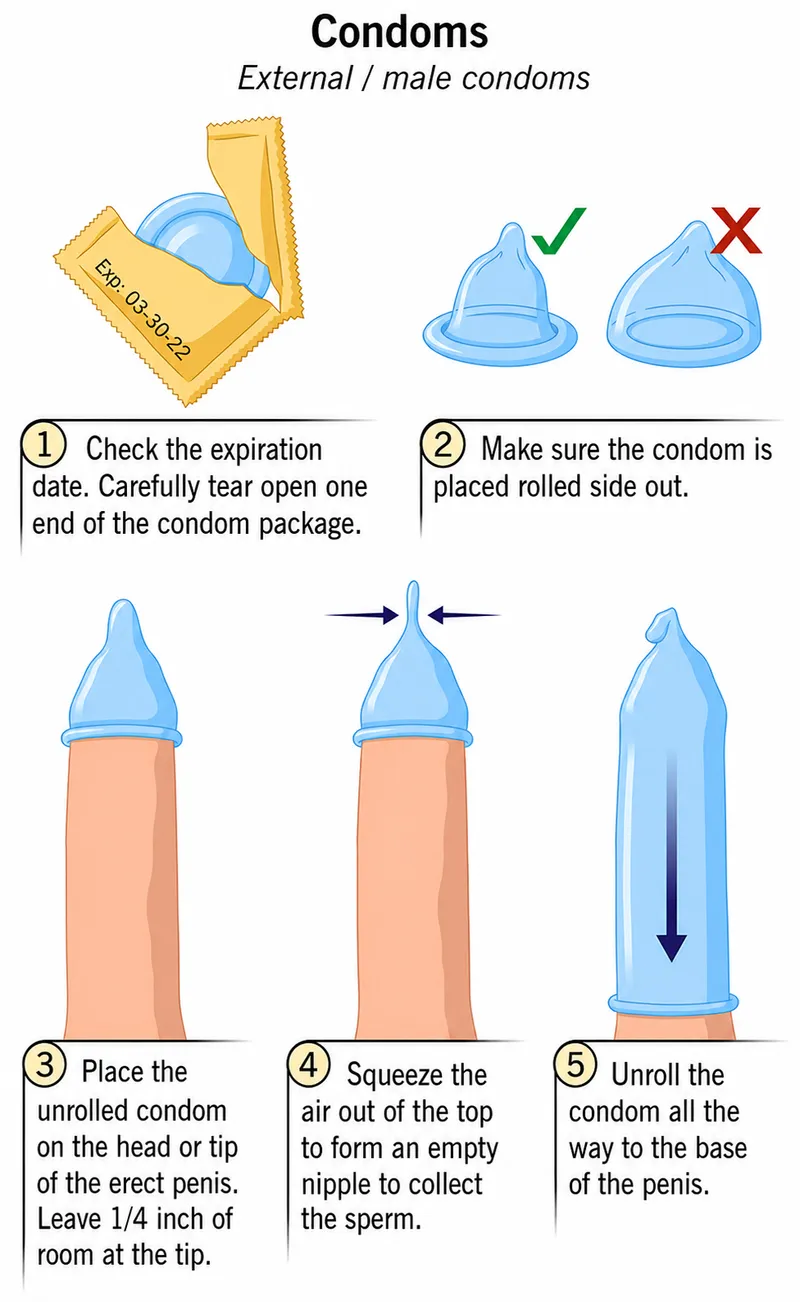 Steps for correct external condom use