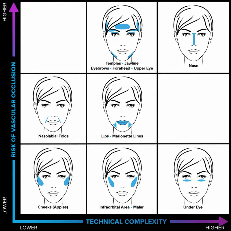 Facial Injection Danger Zones and Vascular Occlusion Risk