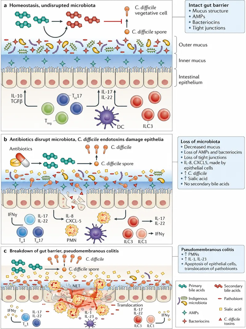 C. difficile infection: Microbiome disruption and FMT