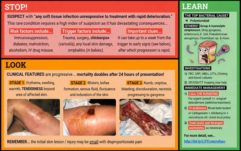 Necrotizing Fasciitis: Clinical Features and Management