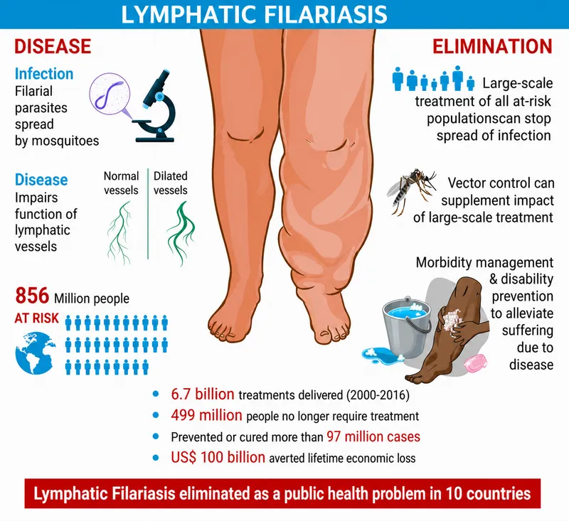 Lymphatic Filariasis: Disease, Impact, and Elimination