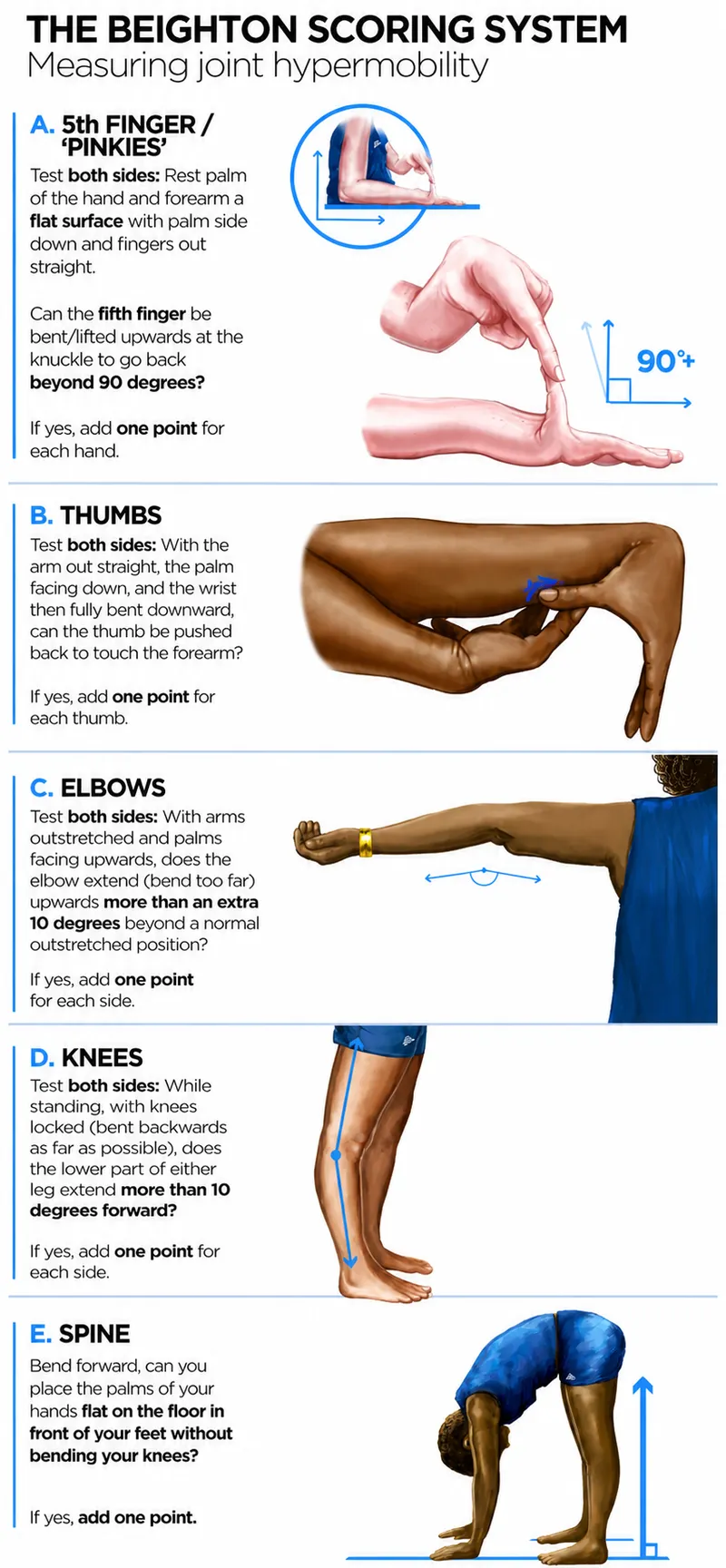 Beighton Scoring System for Joint Hypermobility