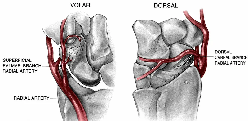 Scaphoid blood supply: Volar and Dorsal views