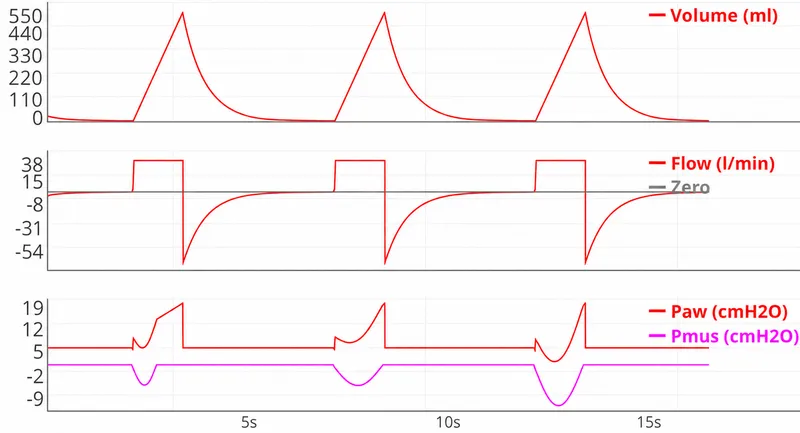 VCV mode waveforms: Volume, Flow, Paw, Pmus