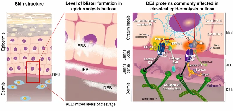 EB cleavage planes and affected proteins