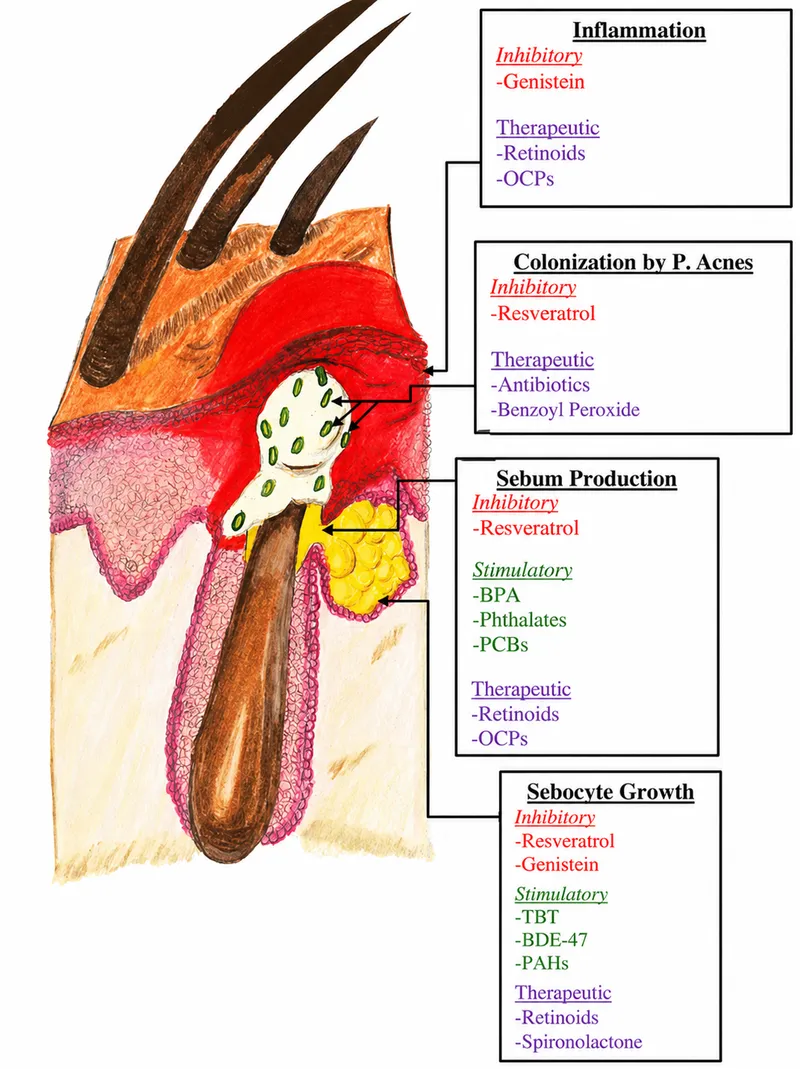 Factors influencing sebaceous gland activity and acne