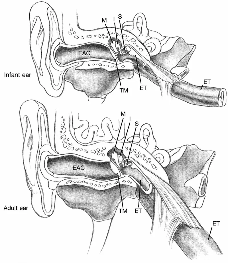 Eustachian tube angle development from infant to adult