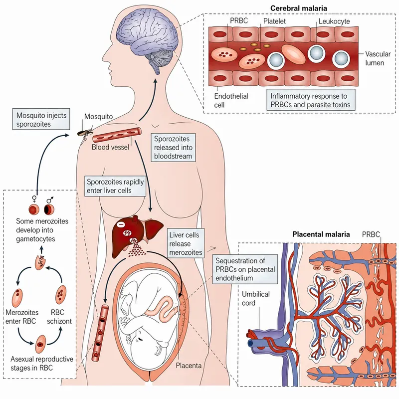 Malaria parasite life cycle and complications