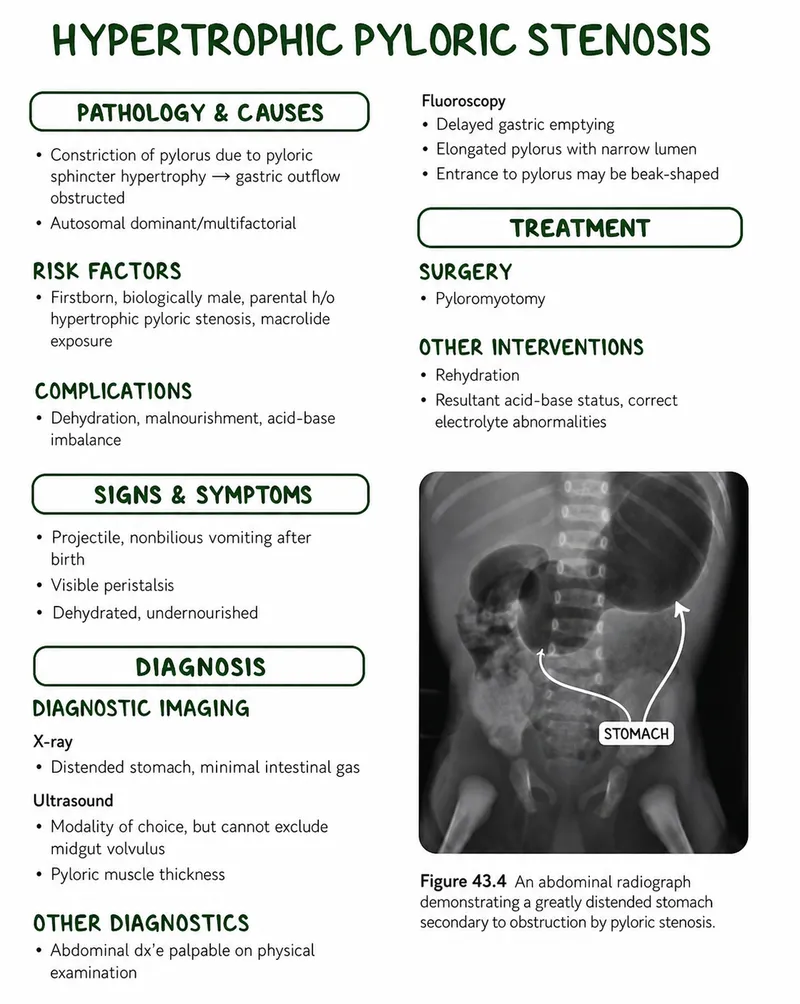 Hypertrophic Pyloric Stenosis Overview