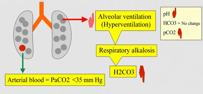 Hyperventilation and Respiratory Alkalosis Diagram