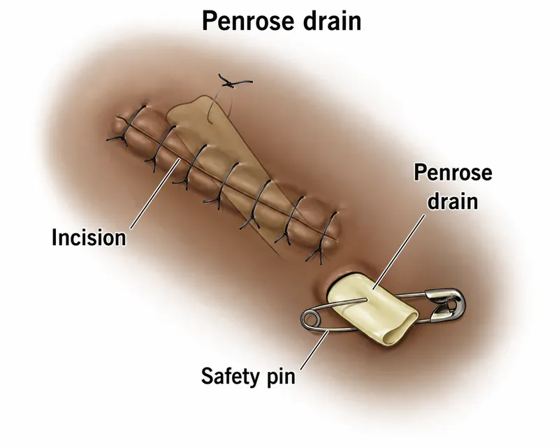 Penrose drain in situ with safety pin