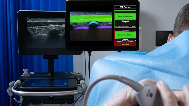 Ultrasound-guided nerve block procedure