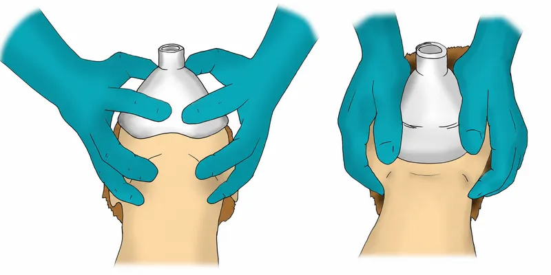 Mask ventilation: E-C clamp technique