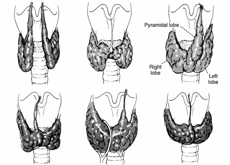 Thyroid gland anatomy and goiters