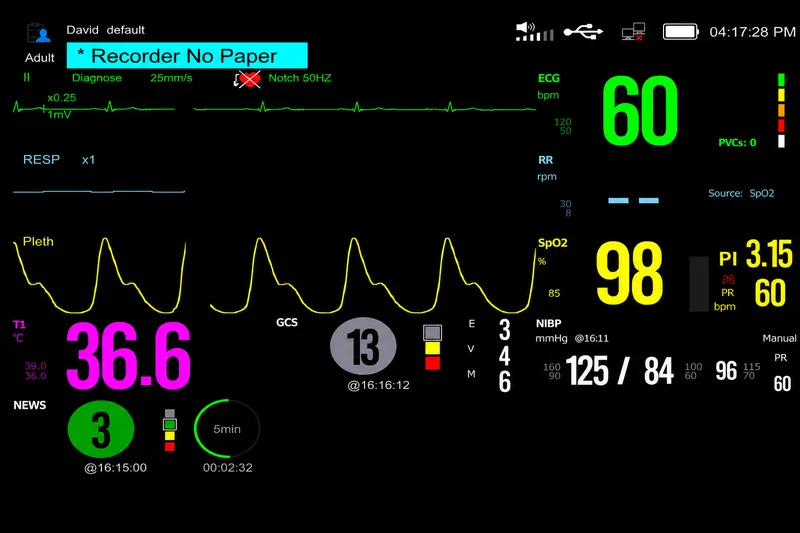 PACU Monitor Displaying Vital Signs