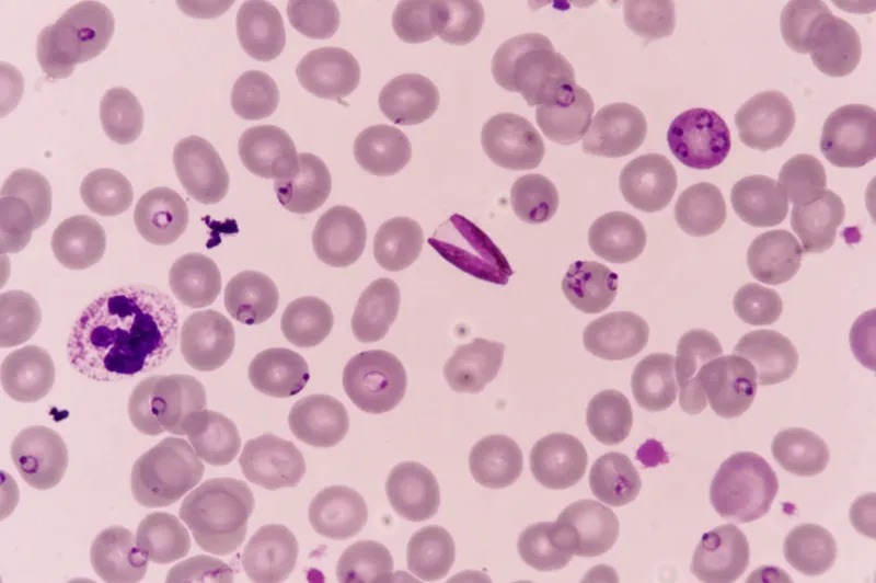 Plasmodium falciparum ring forms and gametocytes