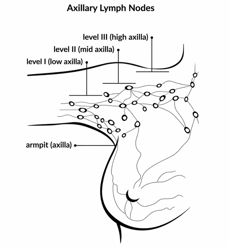 Axillary Lymph Node Levels Diagram