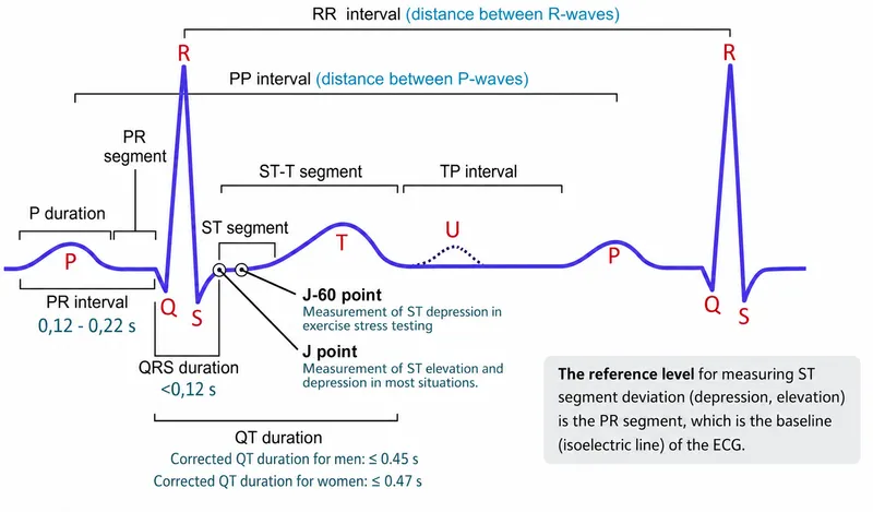 ECG Waveform Components and Intervals