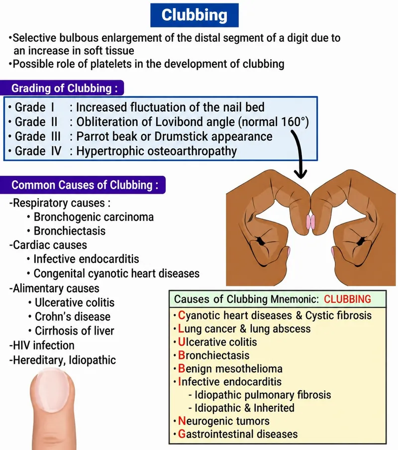 Clubbing: Grading, Causes, and Mnemonic